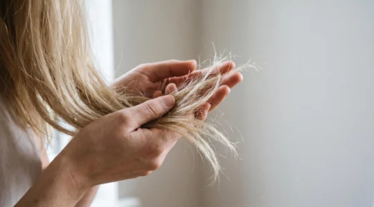 Cheveux très abîmés nécessitant une réparation d'urgence après décoloration